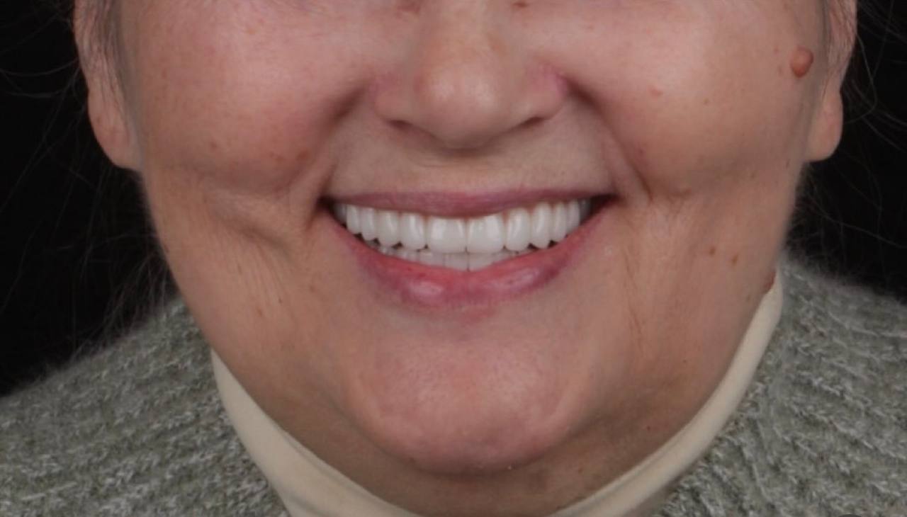 results